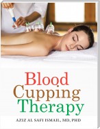 Blood Cupping Therapy