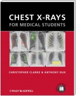 Chest X-rays for Medical Students