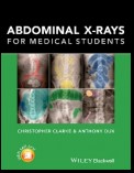 Abdominal X-rays for Medical Students