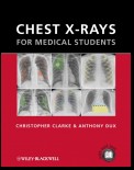 Chest X-rays for Medical Students